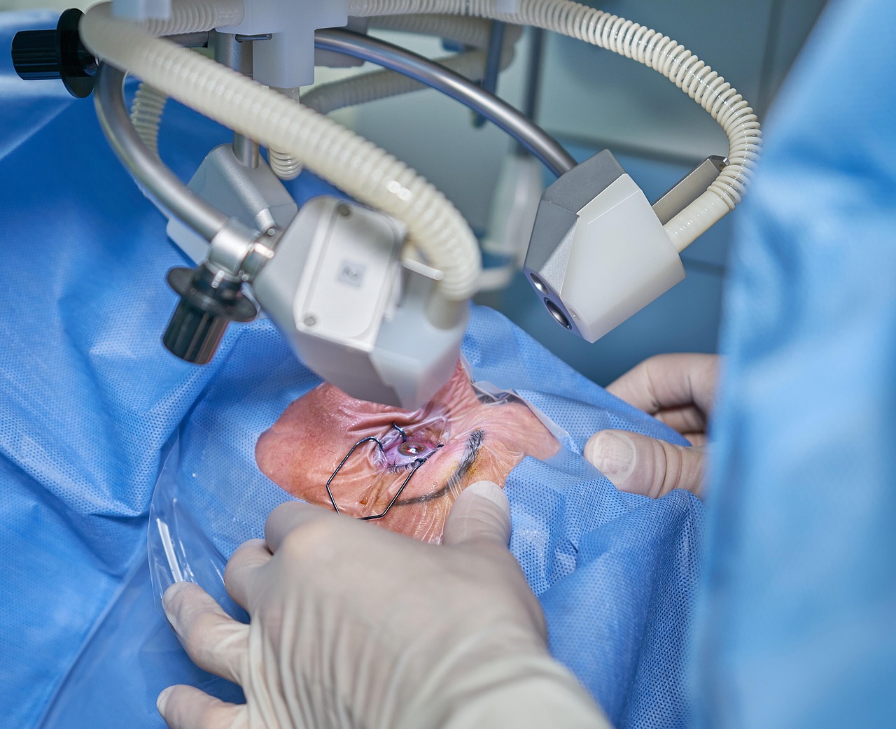 Augenprobleme im Alter: Welche Symptome sollten Sie kennen?